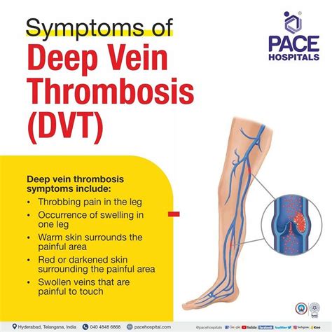 Wembanyama's Health: DVT Diagnosis